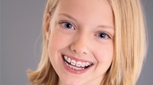 “错过孩子最佳矫治牙齿时机了？！”很多家长很郁闷